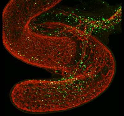 Lymphocytes (1 of 2)