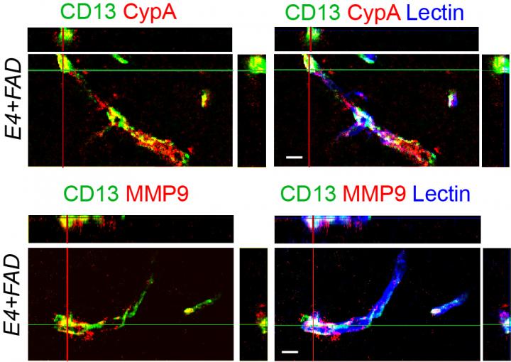 Cyclophilin A-MMP9 pathway in CD13+-pericytes
