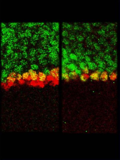 Insights Into Notch Signaling (1 of 5)