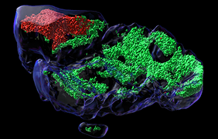Cellules tumorales (rouge) cultivées dans une microstructure (tissu hôte; vert) appelée organoïde. Le laboratoire Rubin a développé des organoïdes qui serviront d'outil pour étudier les tumeurs dérivées de patients et patientes au niveau cellulaire.