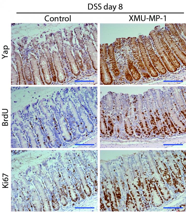 Could a Pill Be Used to Rebuild the Liver? (1 of 2)