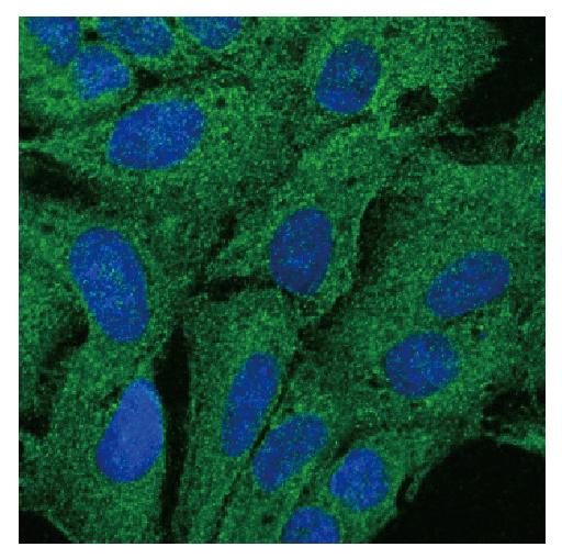 Salk Institute -- Hetzer Lab -- Tpr