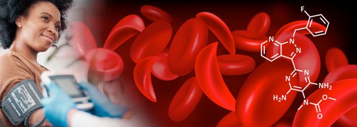Potential New Treatment to Manage Complications from Sickle Cell Disease (IMAGE)