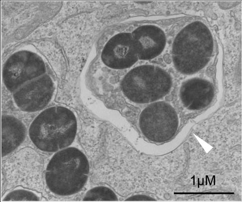 Figure 2 Electron Microscopy Image of GAS