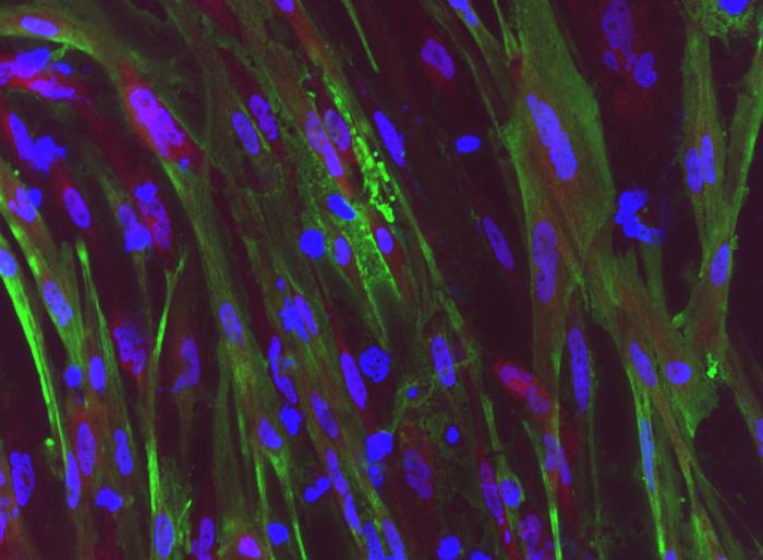 Dystrophin protein restoration in stem cells