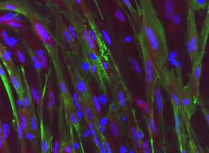 Dystrophin protein restoration in stem cells