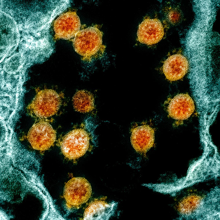 Colorized transmission electron micrograph shows SARS-CoV-2 virus particles (orange), isolated from a patient.