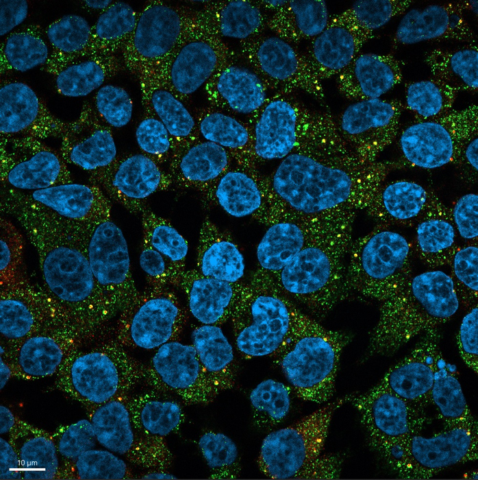 Human cells with a disease-causing RBM20 mutant
