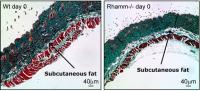 Subcutaneous Fat