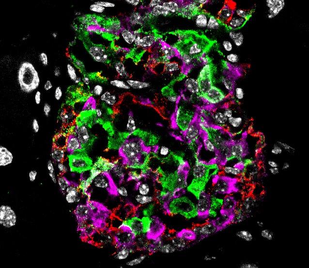 Pancreatic Islet from a Diabetic Mouse