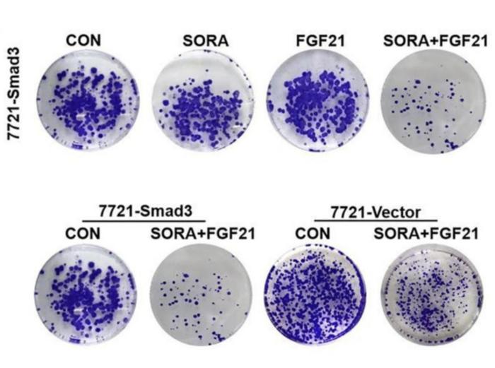 FGF21 combined with SORA promotes apoptosis and inhibits proliferation of 7721‐Smad3 cells under anaerobic conditions