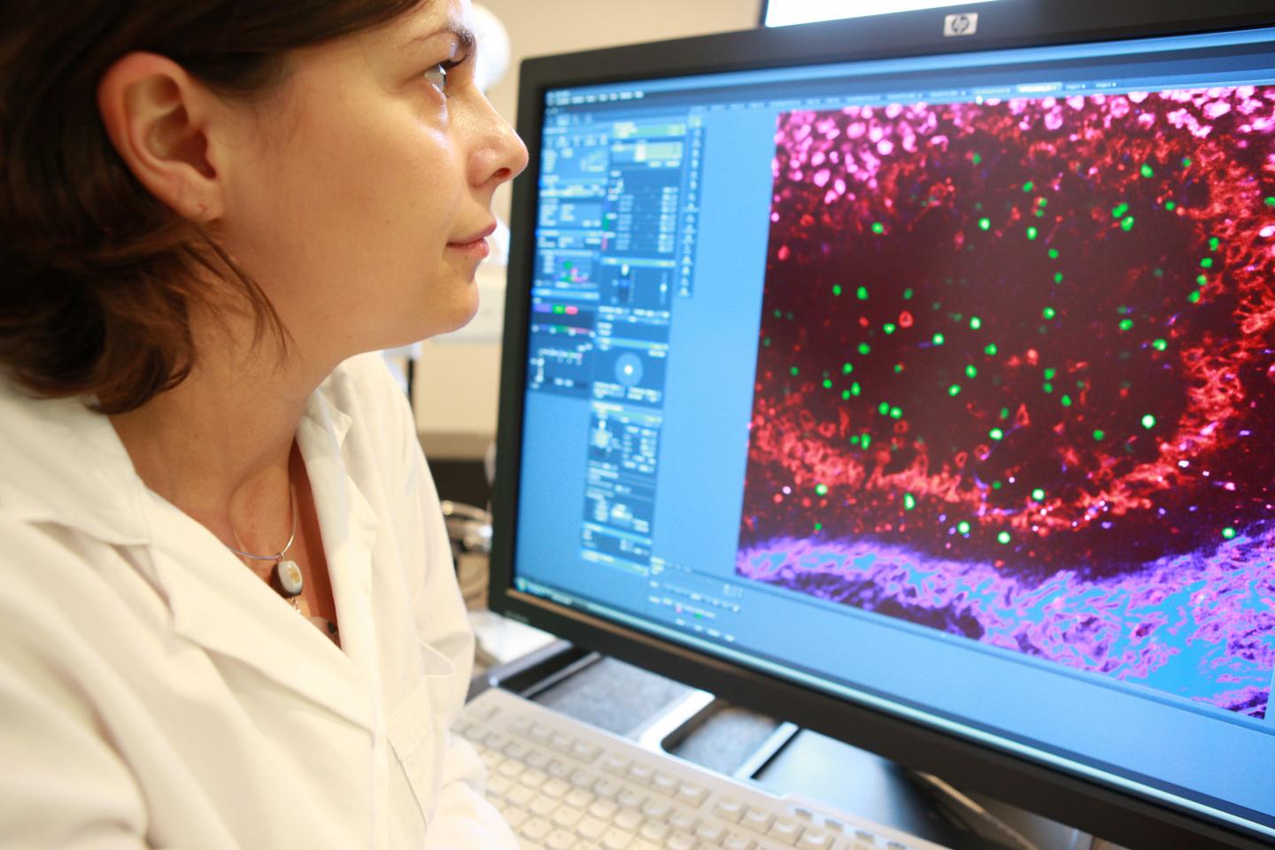 Tatyana Chtanova, Garvan Institute of Medical Research