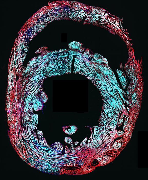 Gene Therapy in Mouse Heart