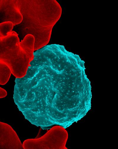 Red Blood Cell Infected with Malaria Parasites