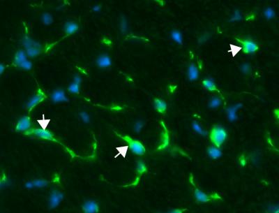Treatment Spurs Cell Division