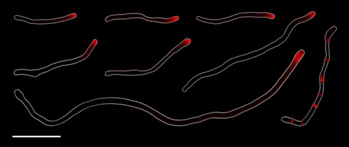 Cellular elongation at the tips of Corynebacterium matruchotii