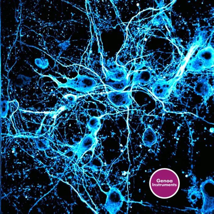 PRISM – Photon-Resolved Image Scanning Microscope