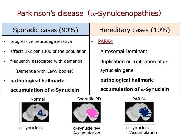 Stopping Parkinson S Disease Before It Starts Eurekalert