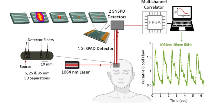 In a new study, researchers from Massachusetts General Hospital developed a superconducting nanowire single photon detector (SNSPD)-based diffuse correlation spectroscopy (DCS) device with a high signal-to-noise ratio and high sensitivity for blood flow.