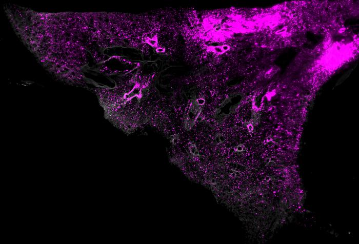 Lipid nanoparticles visualized using SCP-Nano technology at the cellular level in lung tissue.