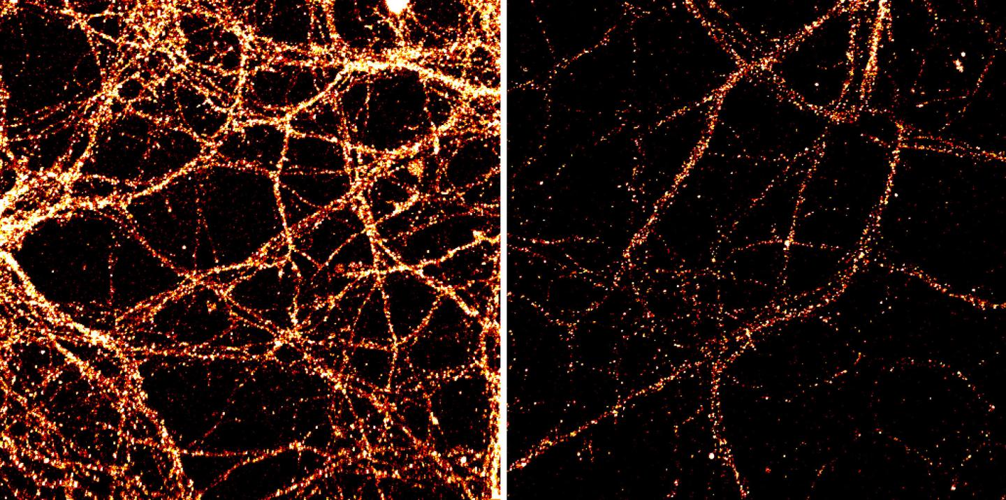 Tet3 Modifies Levels of GluR1 on Neurons