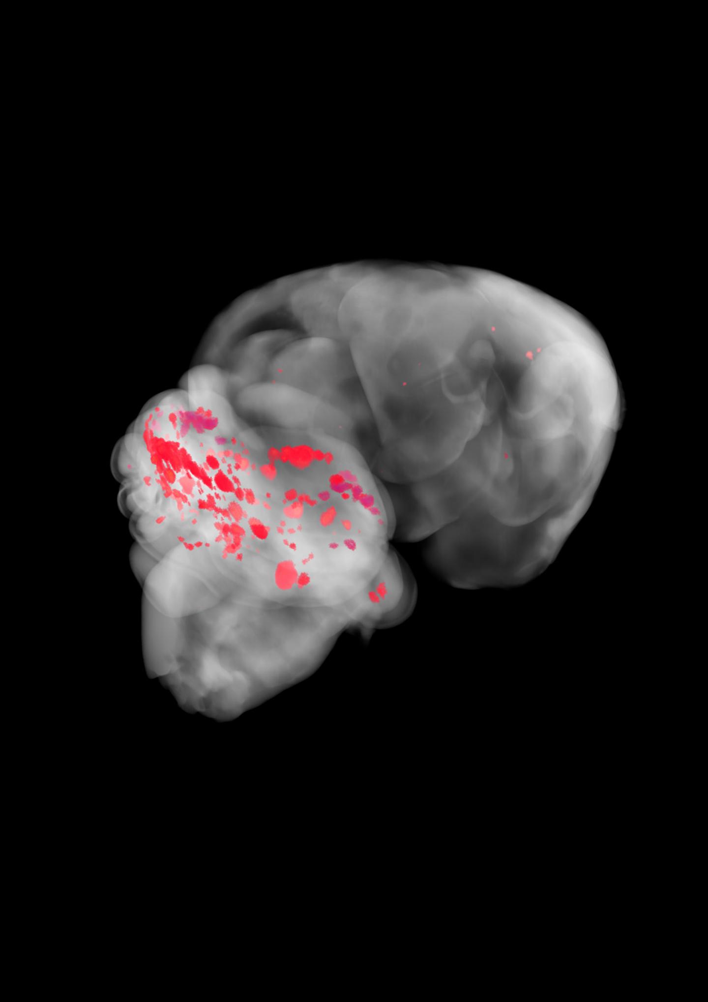 Cerebral Cavernous Malformations