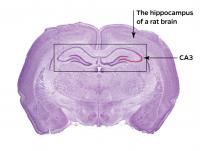 Hippocampus Brain