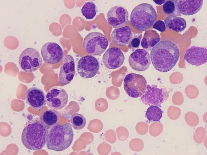 Bone marrow neutrophils