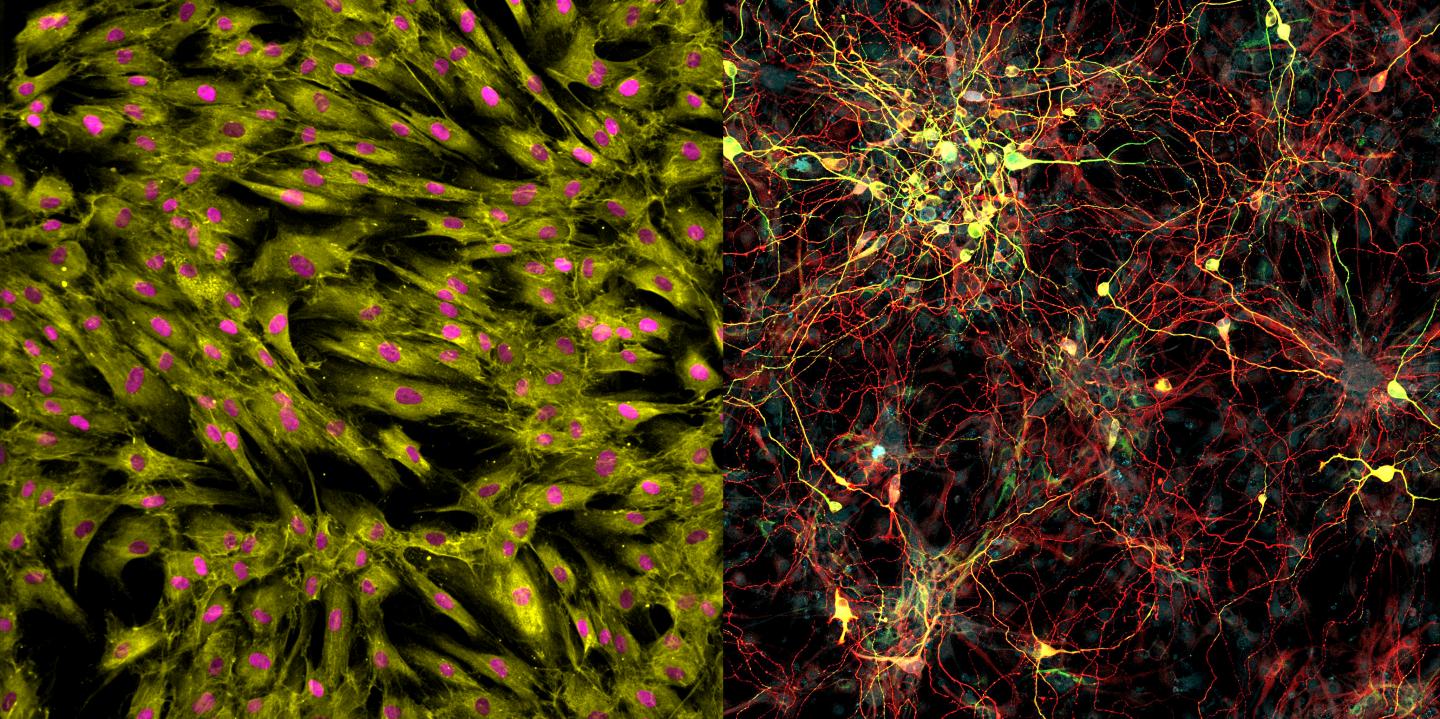 Agining Differences in Induced Neurons
