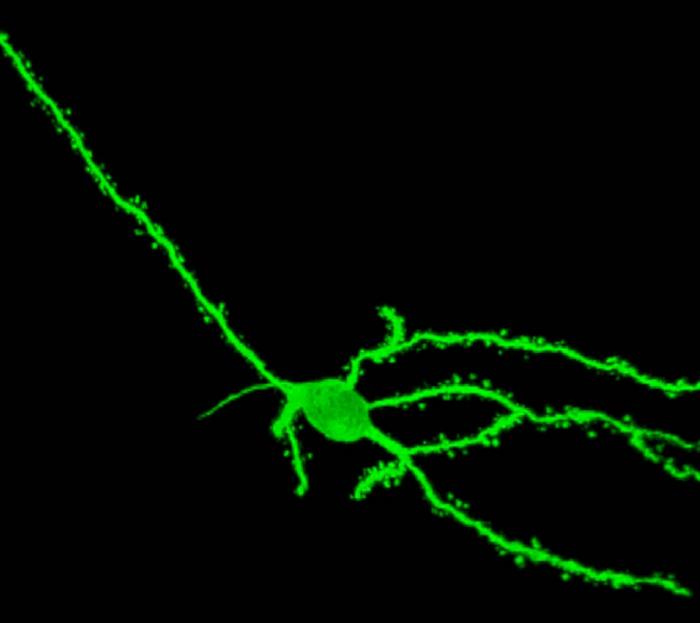 Medium spiny neuron in the nucleus accumbens