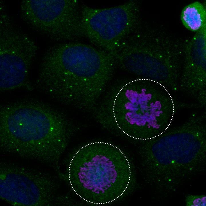 Viewing Autophagy (Or Lack of It) to Confirm Repression of Autophagy during Mitosis