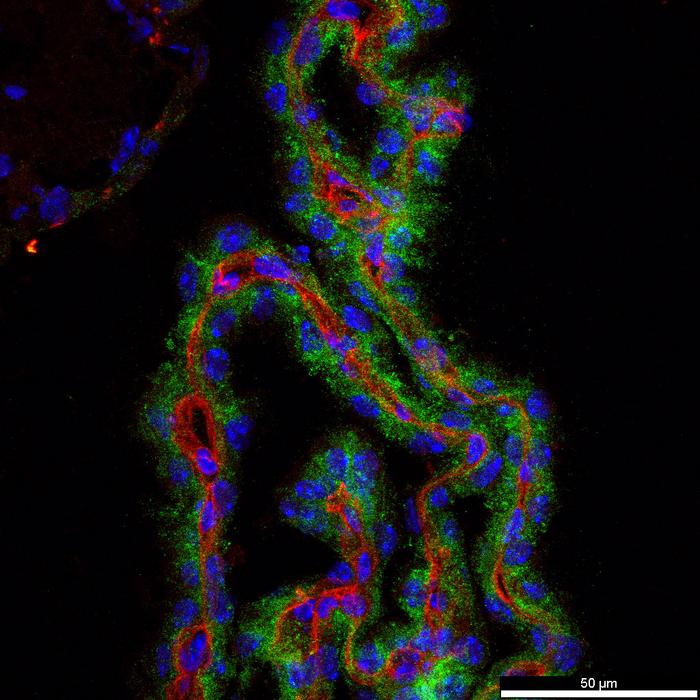 mouse choroid plexus