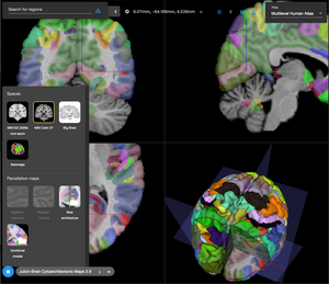 Brain Atlas Interface