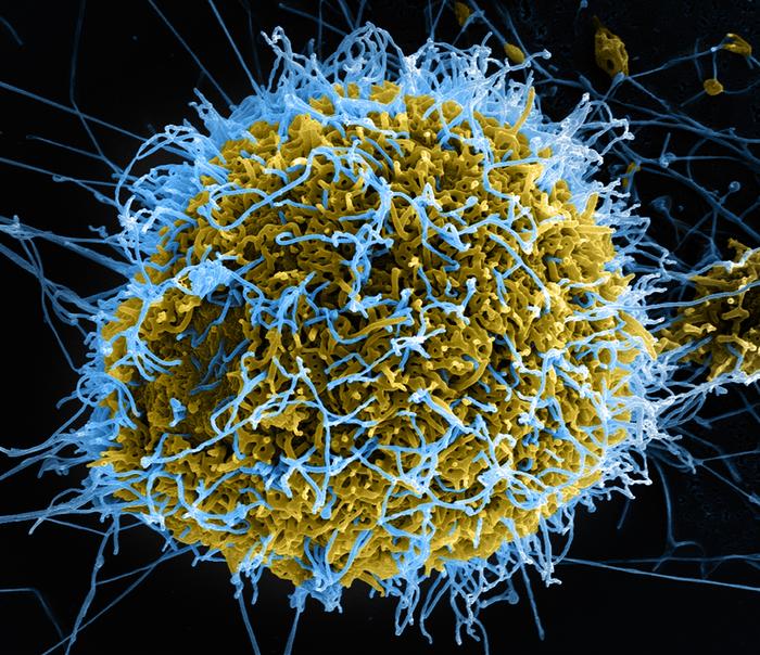 Ebola virus particles_SEM_NIAID