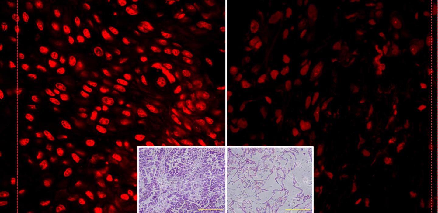 Vitamin C's Effects on Normal Cells Versus Cancer Cells