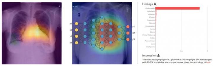 Artificial Intelligence in Medical Imaging