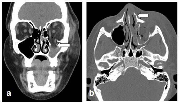 New Study Shows Increase in Domestic Violence Injuries during COVID-19