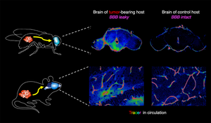 How tumors break down the blood-brain barrier