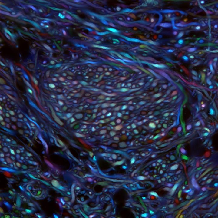 Untangling the Tangled Webs Inside Our Brains