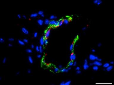 Hydrogel Seeded with Amniotic Fluid Stem Cells