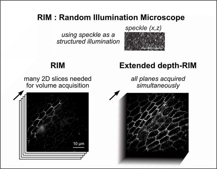 Working Principle of Extended Depth-of-Field Random Illumination Microscopy (EDF-RIM)