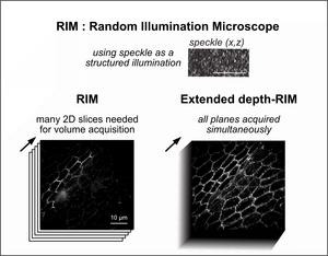 Working Principle of Extended Depth-of-Field Random Illumination Microscopy (EDF-RIM)