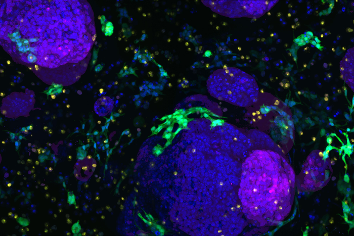 Fibroblasts and Macrophages