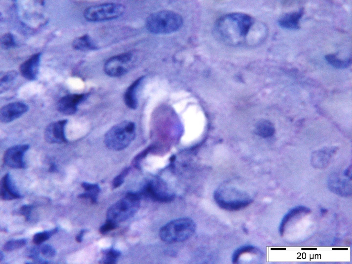 Entamoeba gingivalis