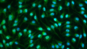 Macrophages in inflammatory phase