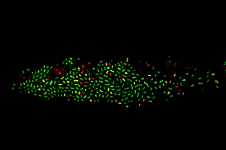pneumococcal bacteria
