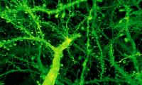 Mouse Brain Neuron