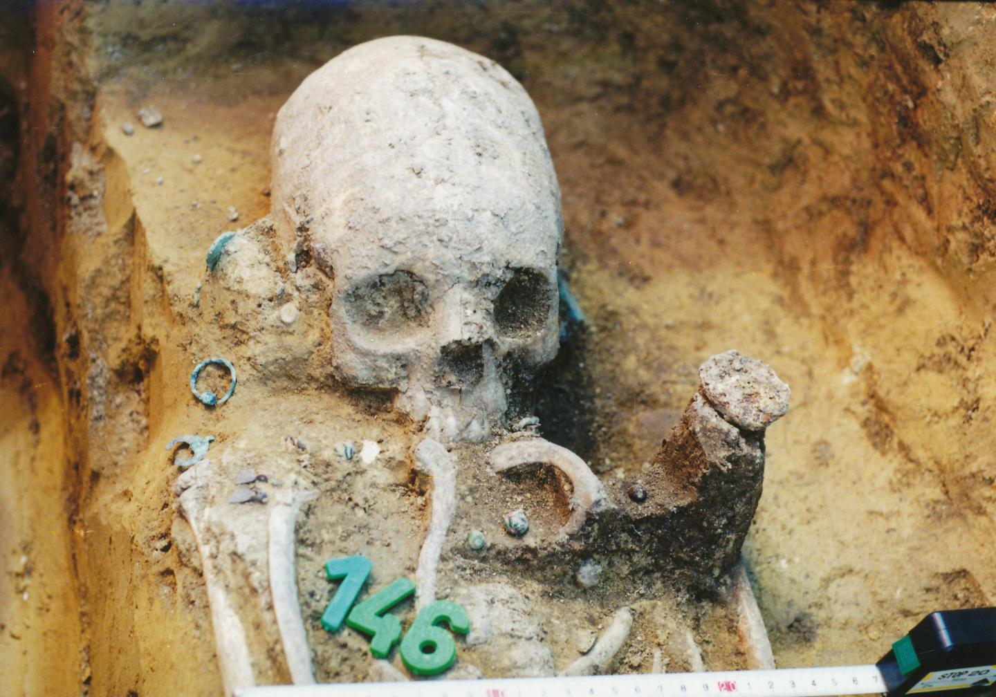 Deformed skulls in an ancient cemetery reveal a multicultural community in transition