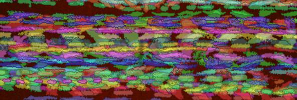 <i>Borrelia burgdorferi</i> Interacting with Human Cells