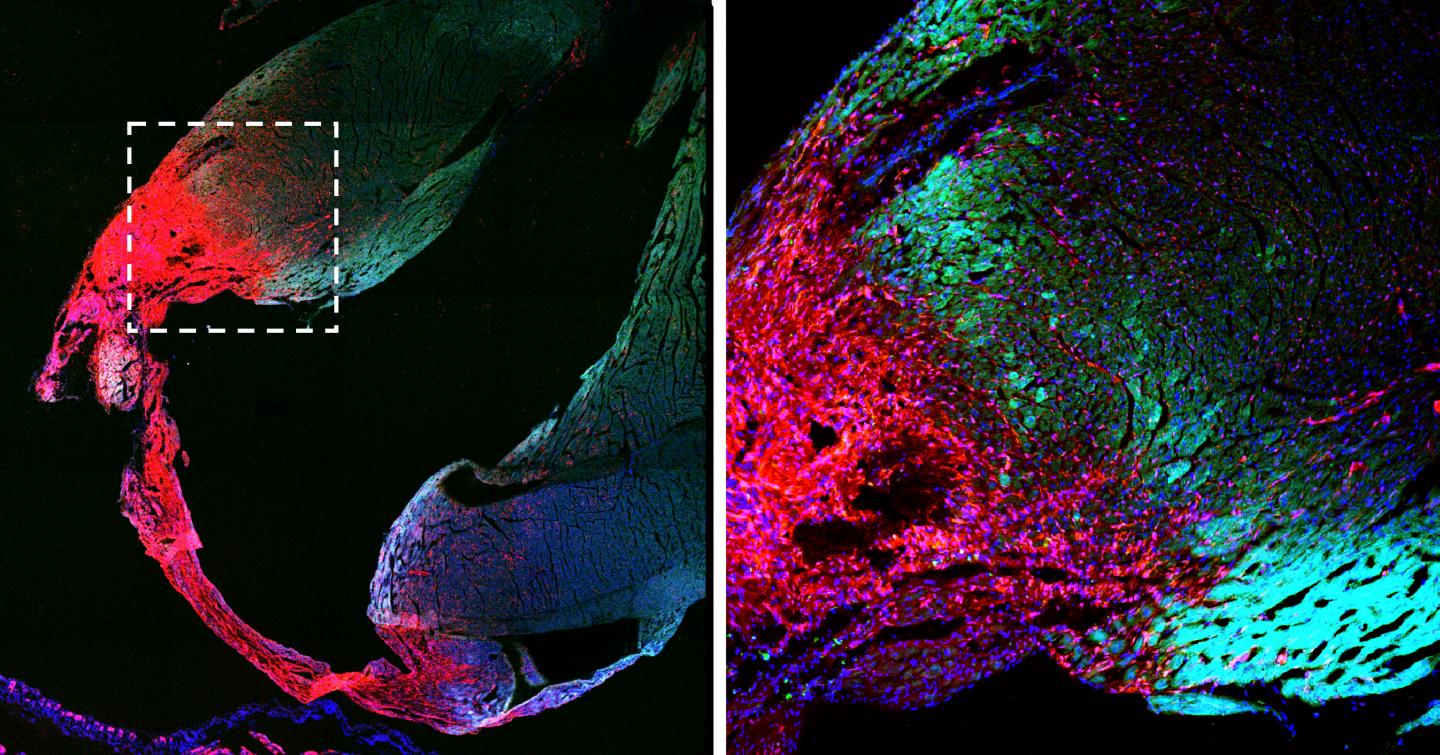 The Scar in the Murine Heart (Red)